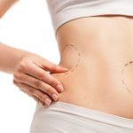 Coolsculpting Treatments